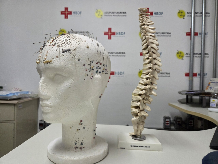  Hospital de Base moderniza acupuntura médica e amplia combate à dor crônica no DF