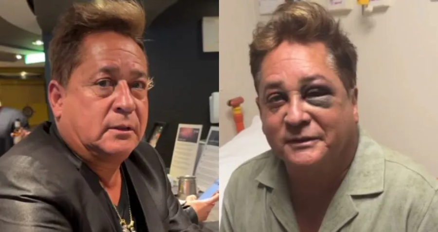 Leonardo abre o jogo sobre acidente em pescaria